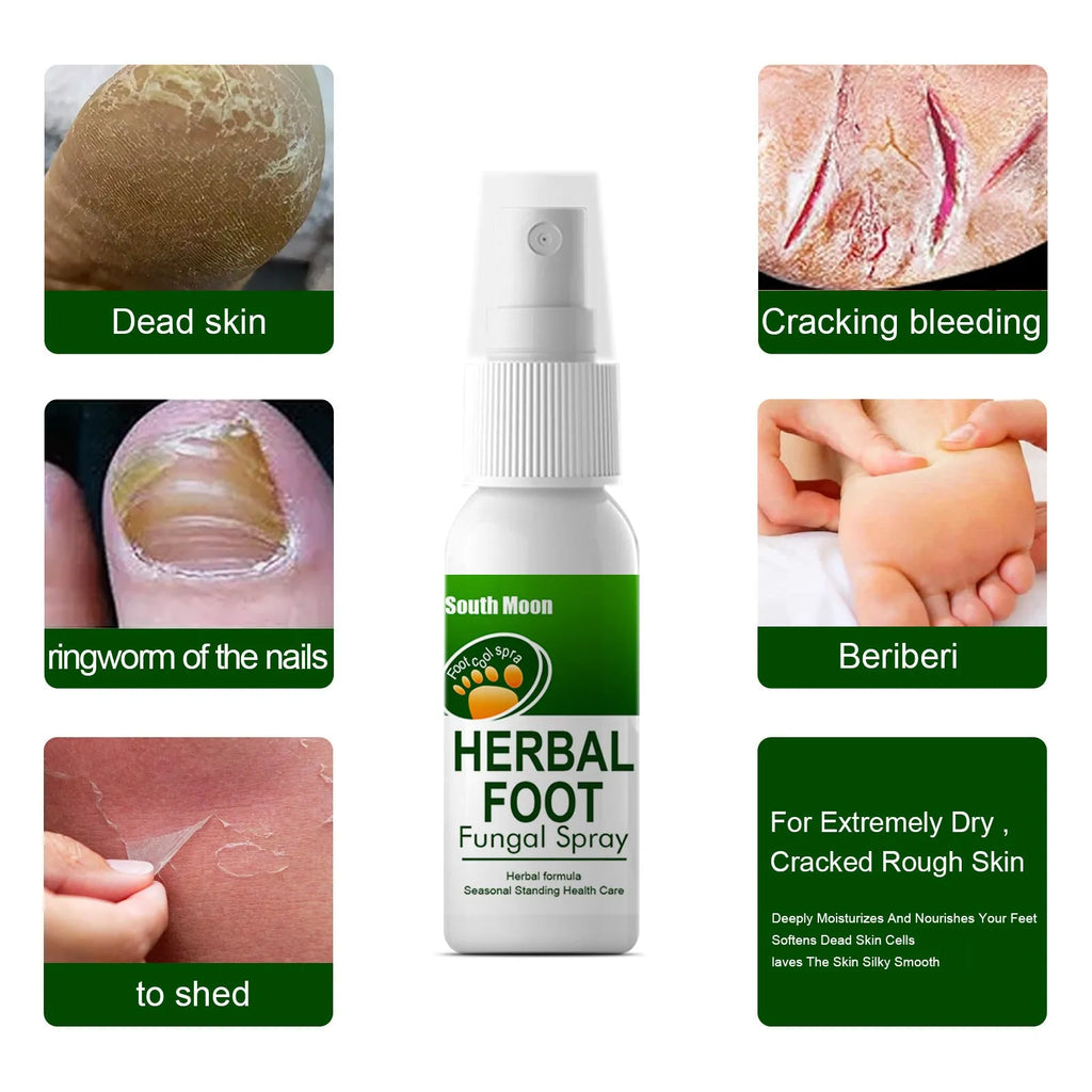 30ml foot skin nourishing and hydrating care spray bottle for dry feet treatment