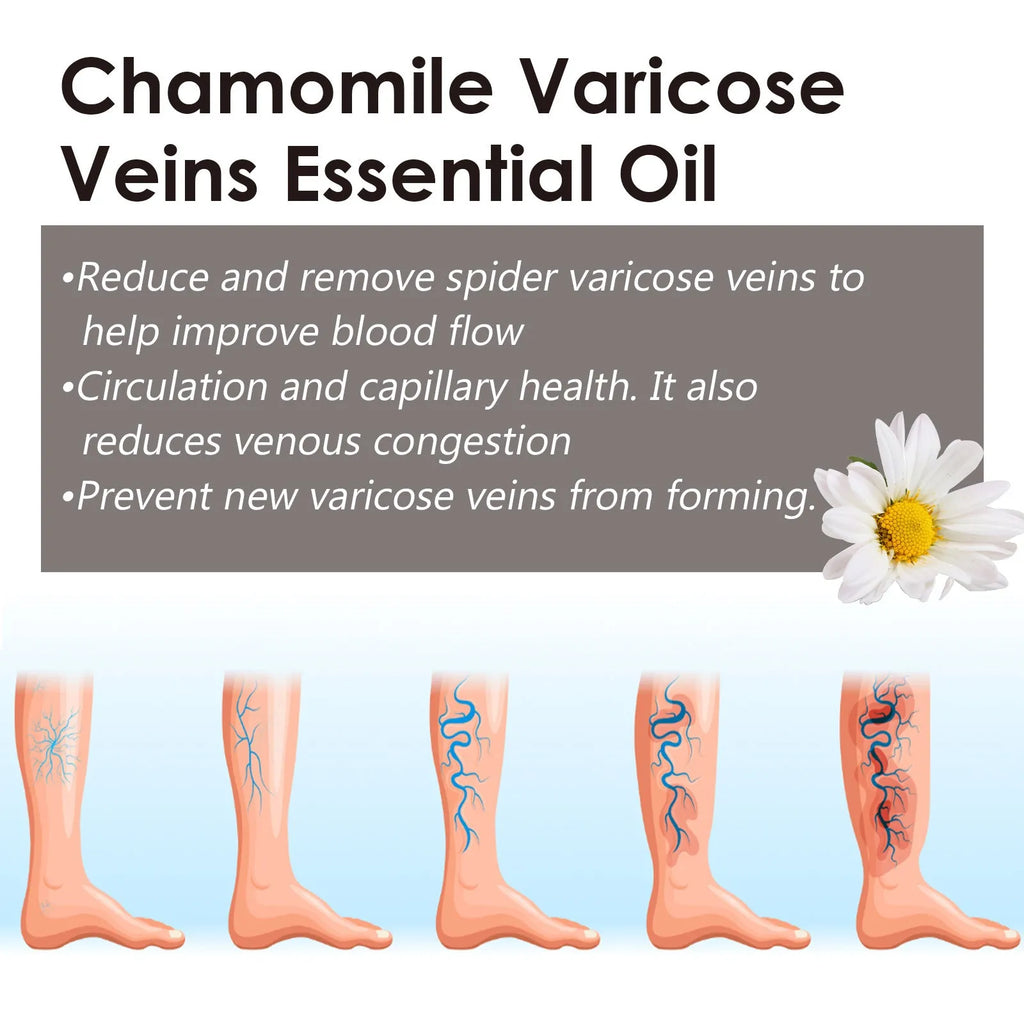 10ml bottle of pure chamomile essential oil for leg care and massage