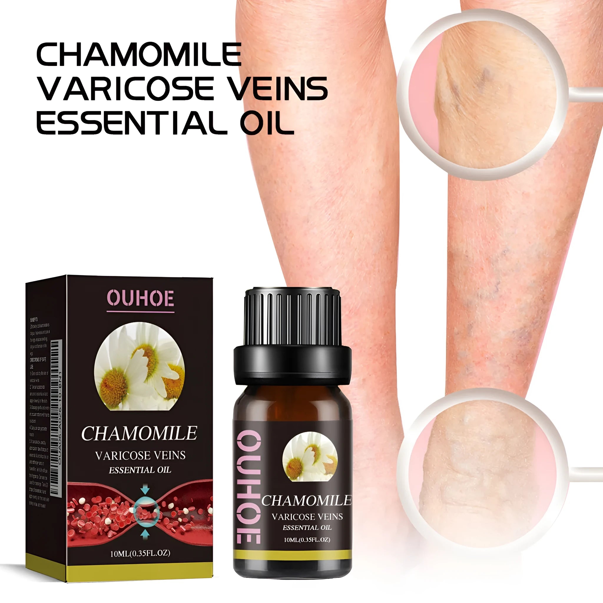 10ml bottle of pure chamomile essential oil for leg care and massage