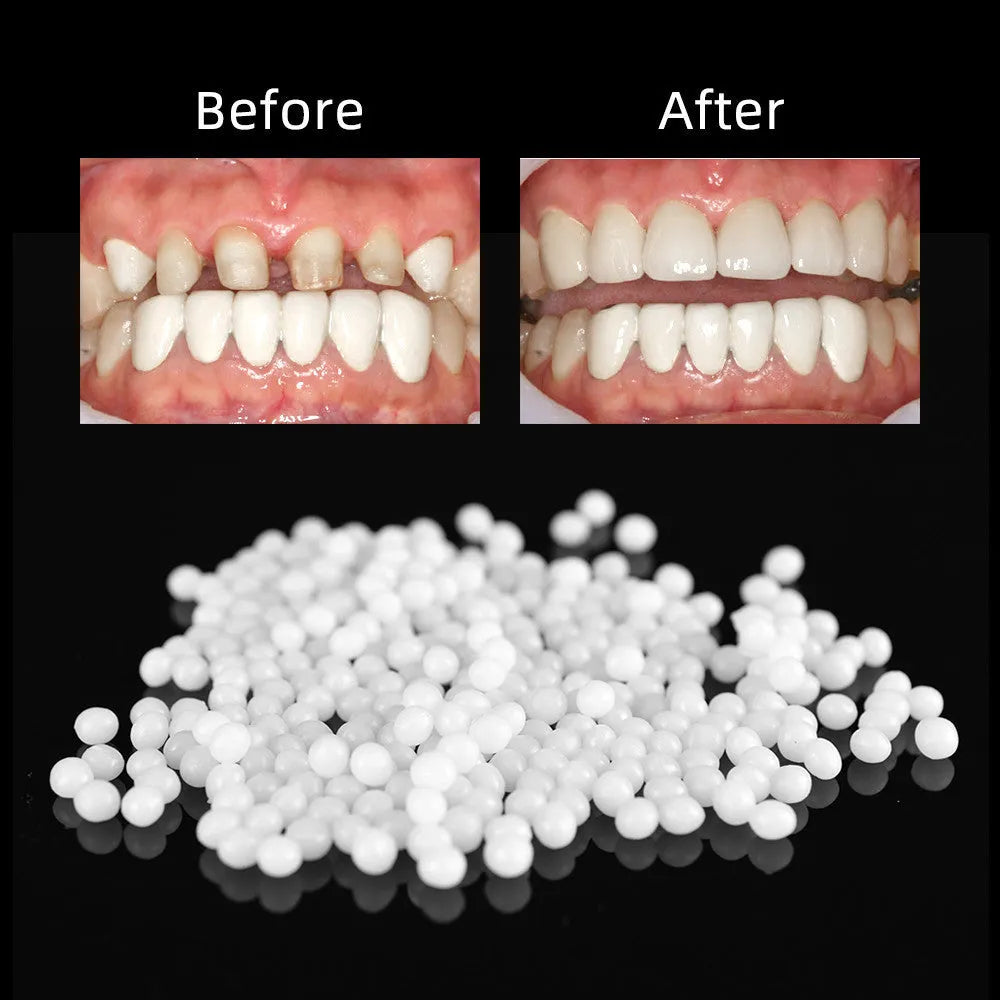 Bagged household teeth repair solid hot-soluble teether for temporary missing teeth gap fix