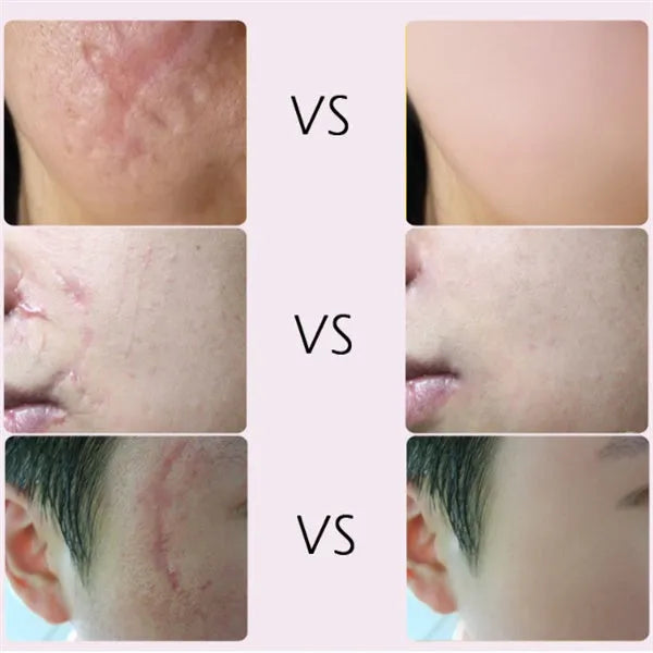 White skin repair body cream for nourishing, moisturising, lifting and firming adult body care