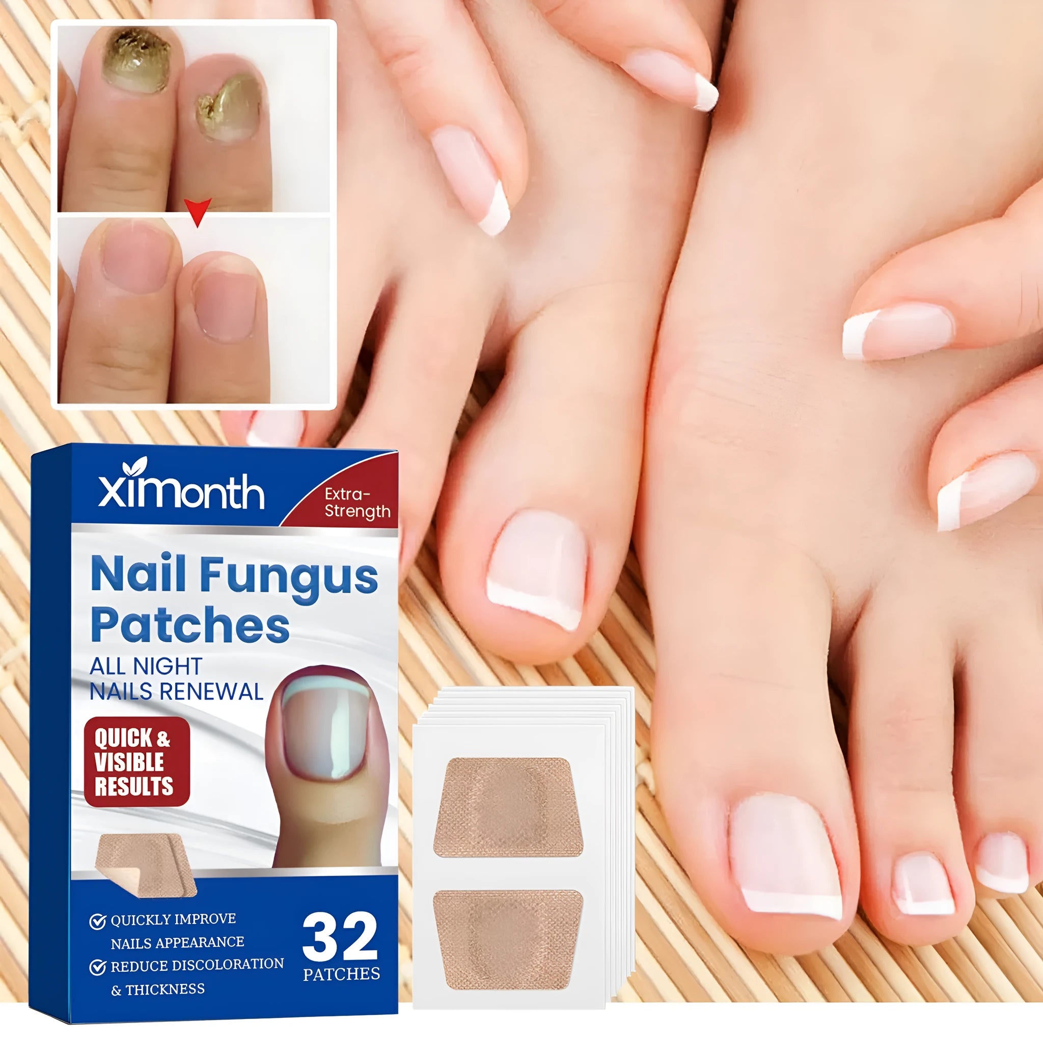 Box of 32 nail nursing adhesive bandage repair patches for weak or broken nails.