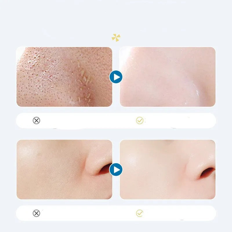 Oligopeptide Small Bubble Cleaning Essence in single-use 1.5ml sachets, 10 per box, with peptide formula for gentle daily face wash