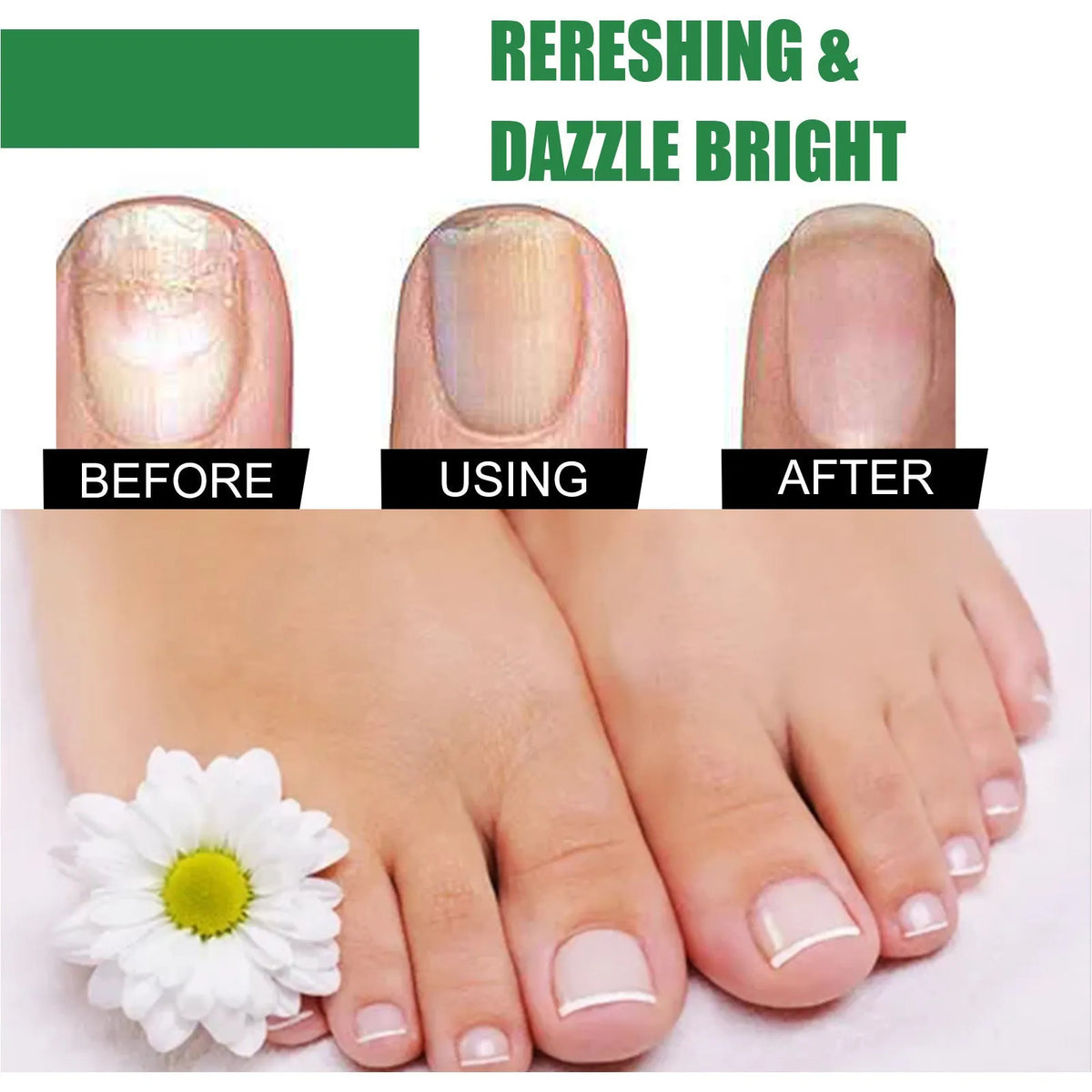 30ml tea tree oil nail care bottle with finger-thick consistency for foot and hand nail nutrition