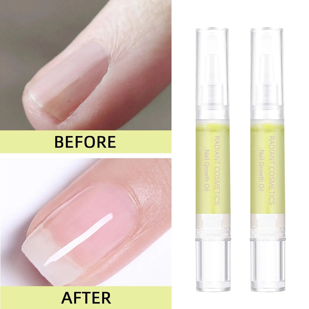 3ml bottle of wash-free nail growth and moisturising treatment oil