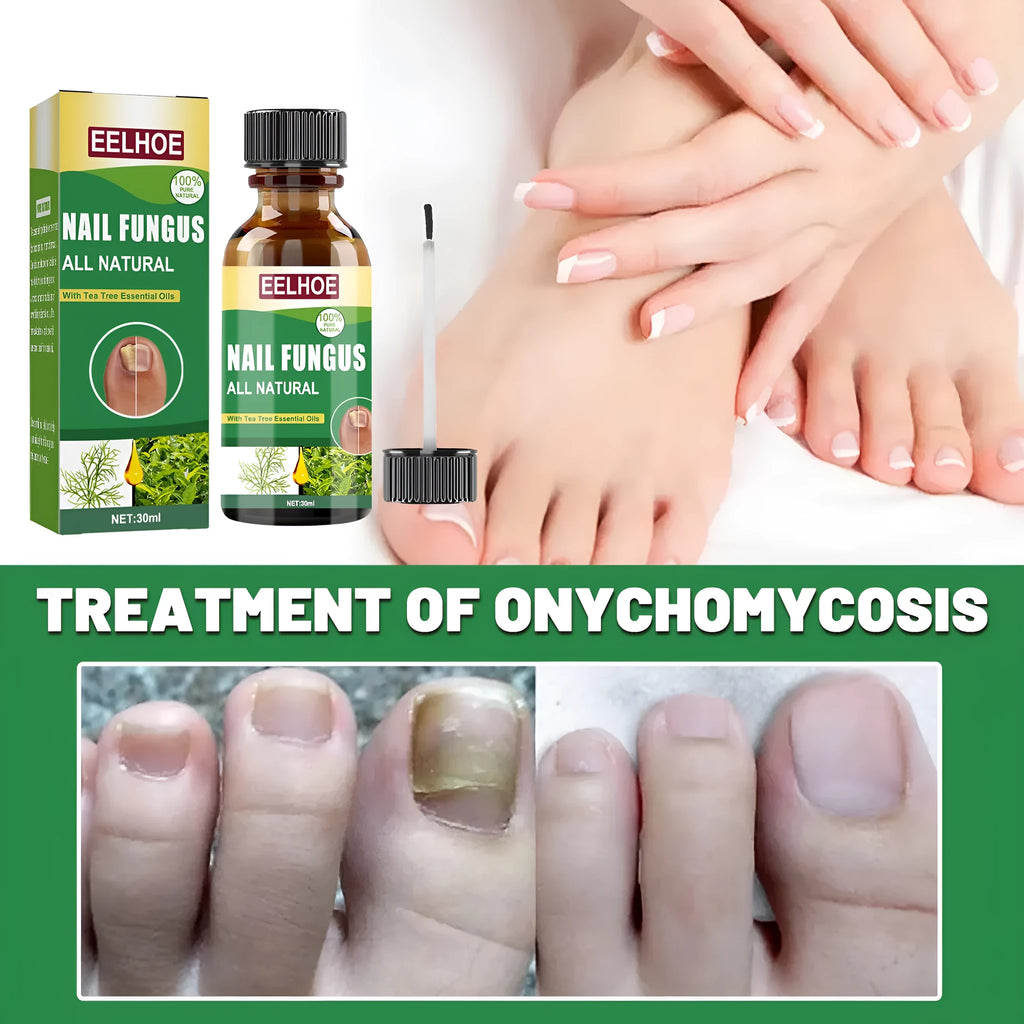 30ml tea tree oil nail care bottle with finger-thick consistency for foot and hand nail nutrition