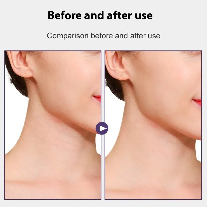 Skin tone neck firming adhesive patches and V27 pattern sling laid out on table