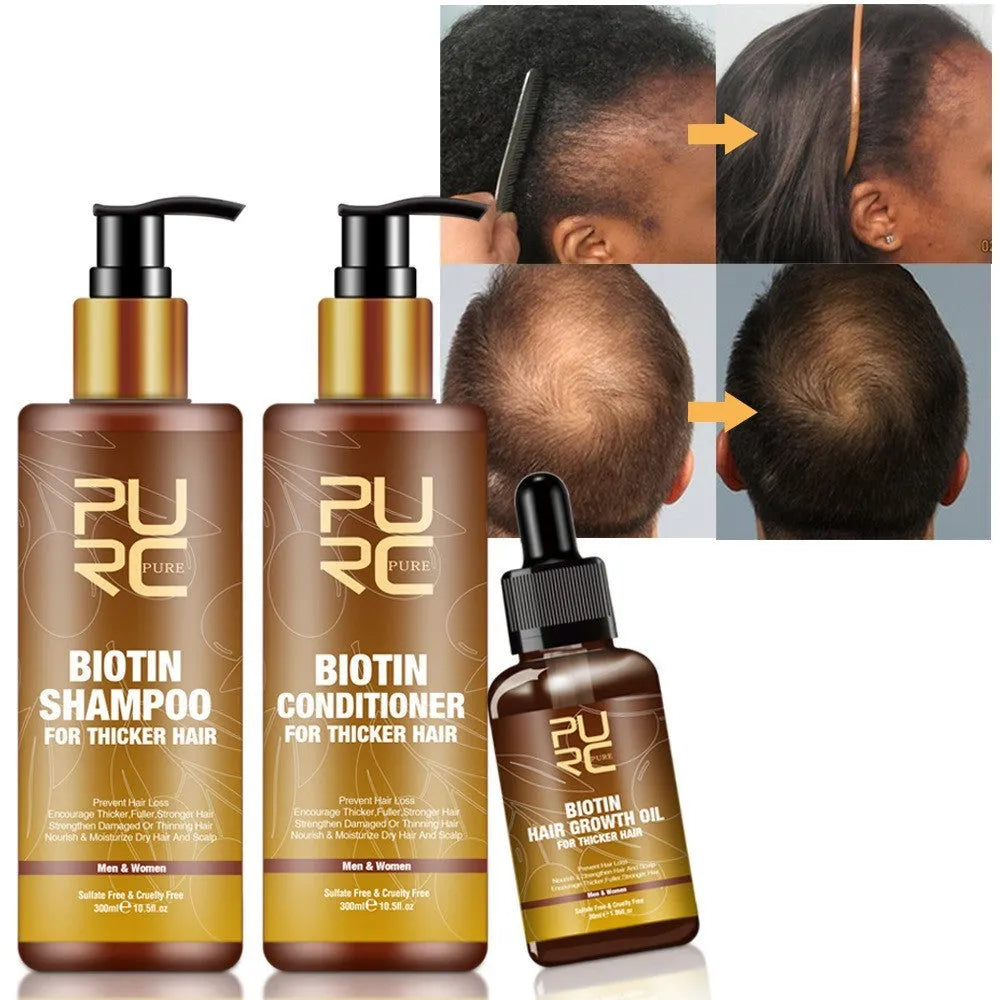 PURC Ginger Biotin three-piece hair care set with shampoo, conditioner, and essential oil in white bottles