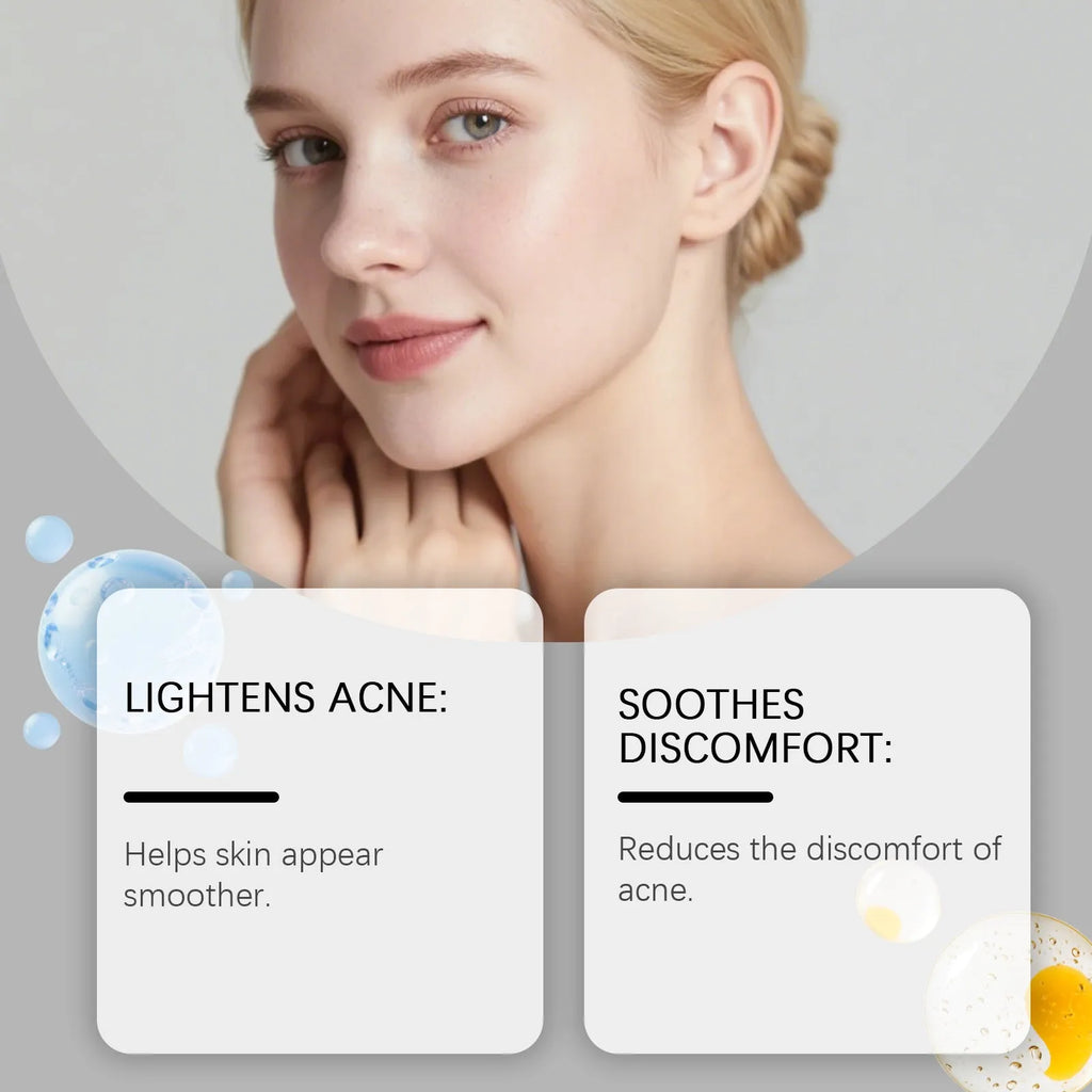 Pack of 80 hydrocolloid facial acne patches for breathable spot treatment
