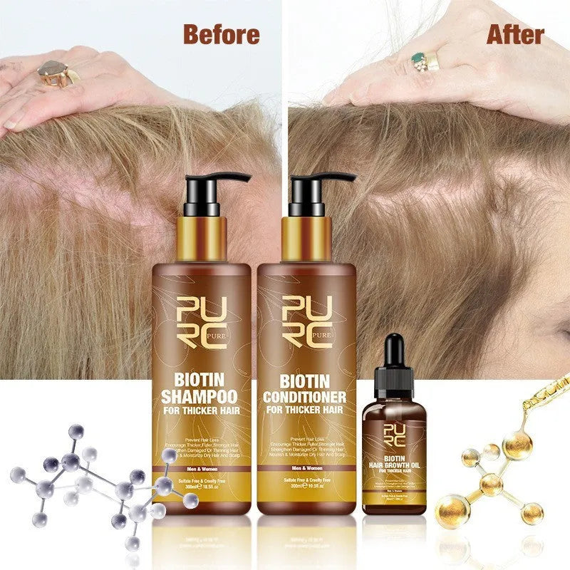 PURC Ginger Biotin three-piece hair care set with shampoo, conditioner, and essential oil in white bottles