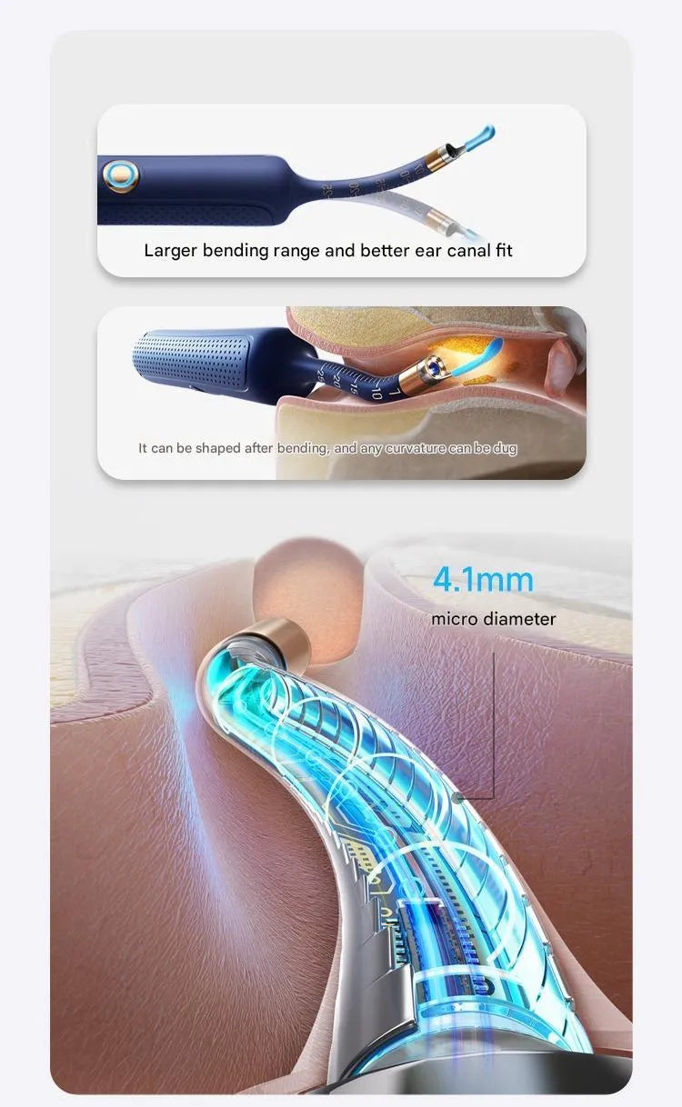 Bebird 3Plus smart visual ear scoop wireless WiFi ear cleaning set with camera in blue