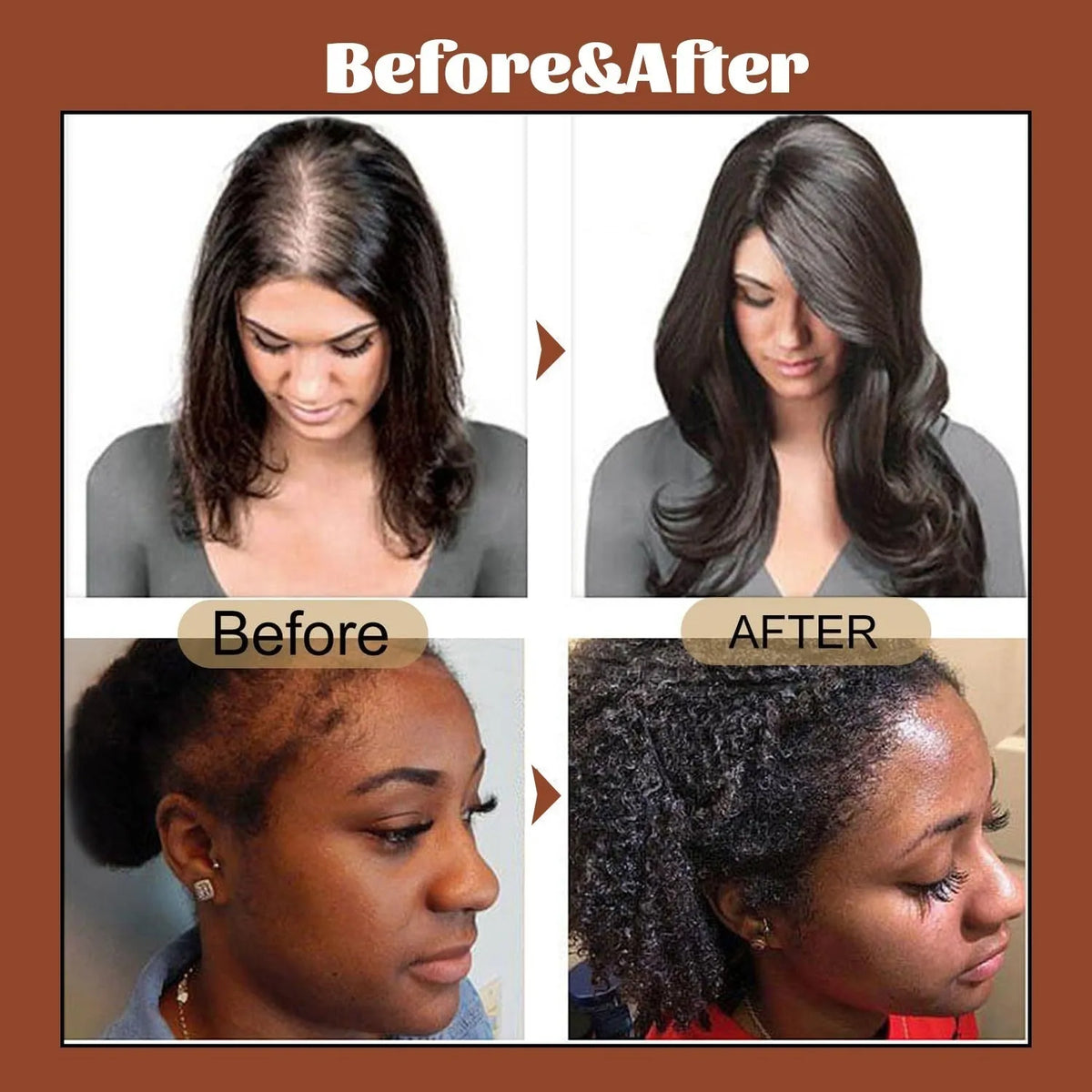 120g hair growth and care oil for women, anti hair loss and frizz control, hair dye protection